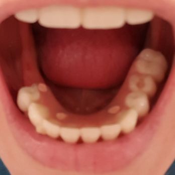 Clear Choice Reviews >> Clearchoice Dental Implant Center 25 Photos Oral Surgeons 3535 Clear Choice Reviews >> Clearchoice Dental Implant Center 25 Photos Oral Surgeons 3535