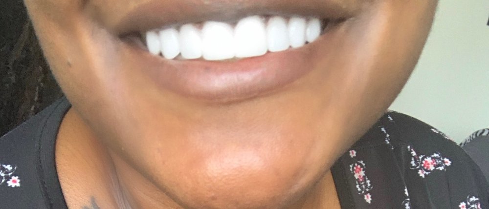 image of business Brown Reynolds Snow Dentistry