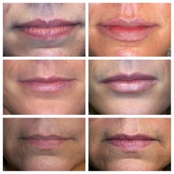 Can find Pickerington jaw and facial necessary Advise you Pickerington jaw and facial