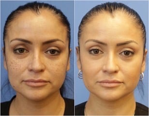 How to lose weight fast and easy at home image 3