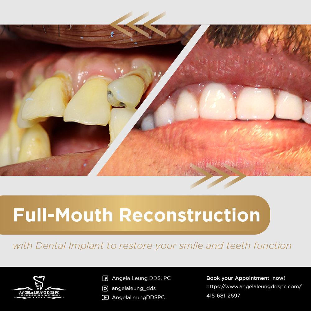 image of business Angela Leung DDS PC - The Endodontics Implant Center