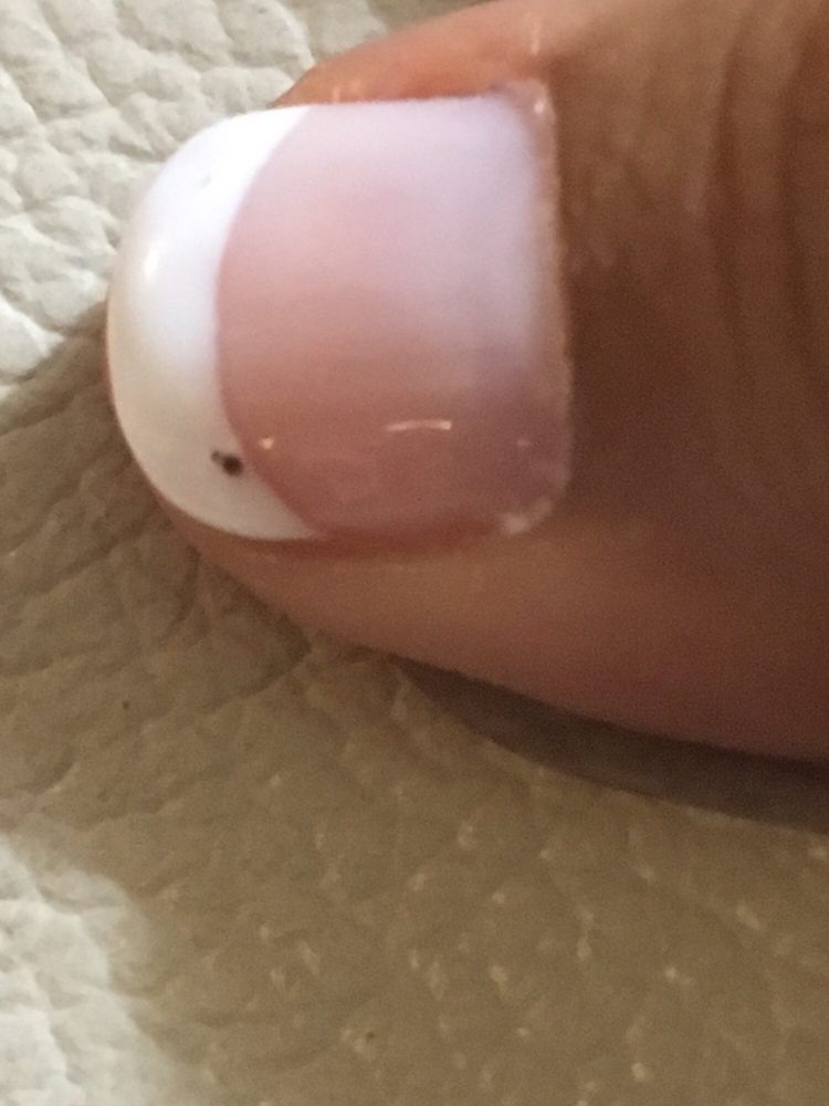Black Spots On Nails Yelp Photo Of Hollywood Nails Campbell Ca United States Black Spots On