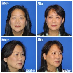 Seattle Plastic Surgery Center - Home - Facebook