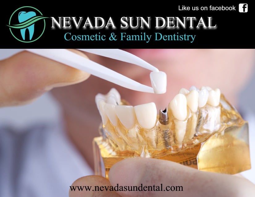 Photos for Nevada Sun Dental Yelp