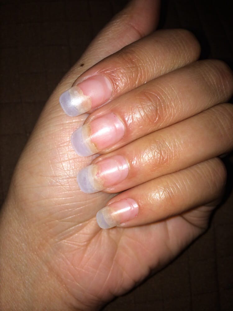The White Part That Is Receding Nail Lifting From Photo Of Mingle Nail Lounge Philadelphia Pa United States The White Part