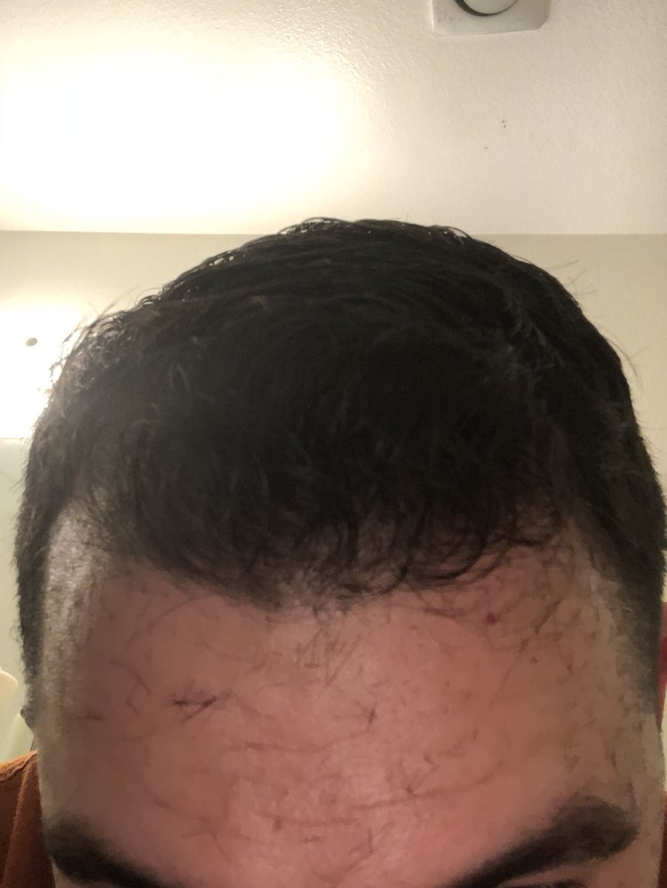 O