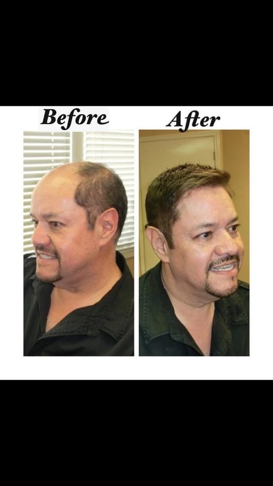 Apollo Hair Systems Men's Hair Salons 23361 El Toro Rd, Lake Forest