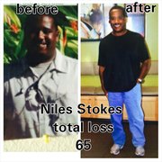 Quick weight loss transformation photo 2
