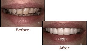 image of business Summit Smile - Bradley J. Smith, DDS, PC