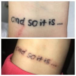 laser loft 13 photos u0026 22 reviews tattoo removal 4372 laser loft 13 photos u0026 22 reviews tattoo removal 4372