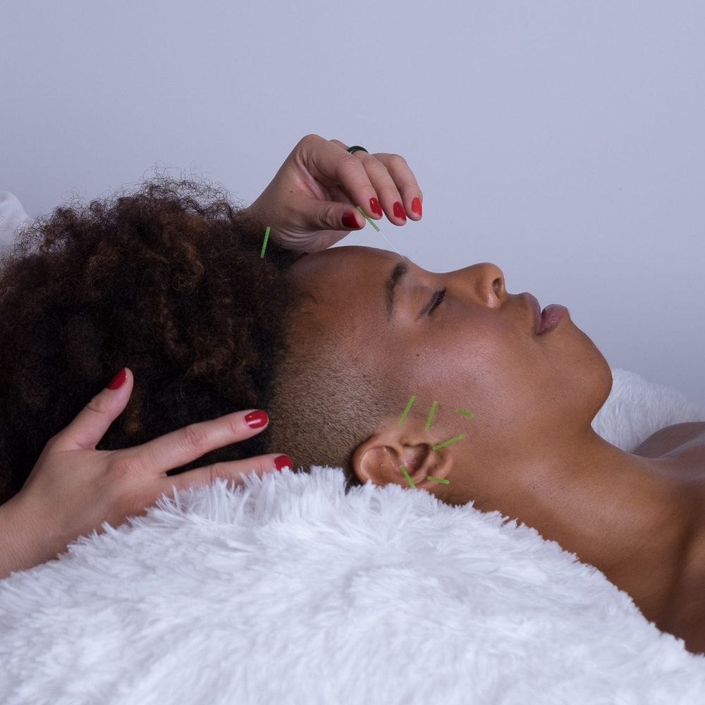 Emily Grace Acupuncture