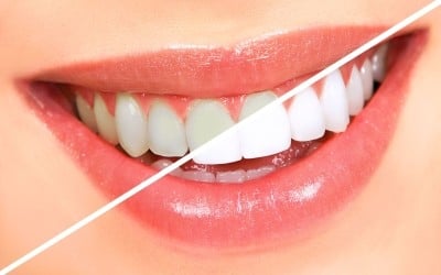 image of business Smile Brighteners