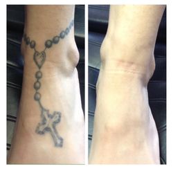disappearing inc 16 photos u0026 10 reviews tattoo removal 25 disappearing inc 16 photos u0026 10 reviews tattoo removal 25