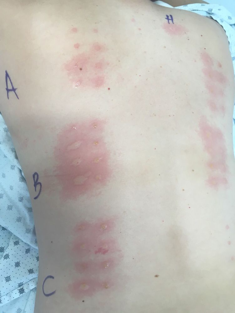 image of business University of Utah Allergy & Immunology Clinic