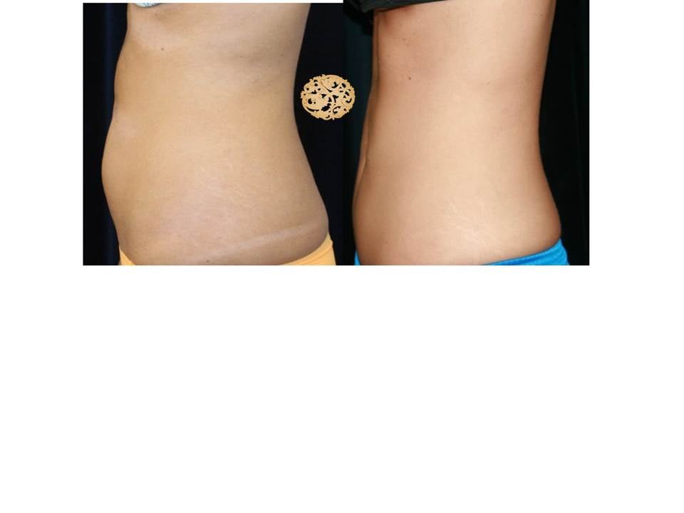 Sheila Nazarian, MD - 53 Photos &amp; 34 Reviews - Cosmetic 