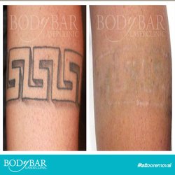 body bar laser clinic 34 photos u0026 16 reviews skin care 2957 body bar laser clinic 34 photos u0026 16 reviews skin care 2957