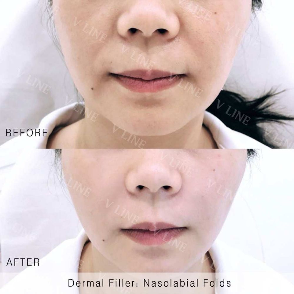 V Line Cosmetic Clinic