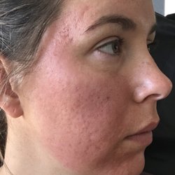 Marinas first facial hope Personal marinas first facial