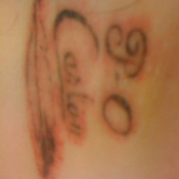 blink tattoo removal 10 photos u0026 13 reviews tattoo removal blink tattoo removal 10 photos u0026 13 reviews tattoo removal