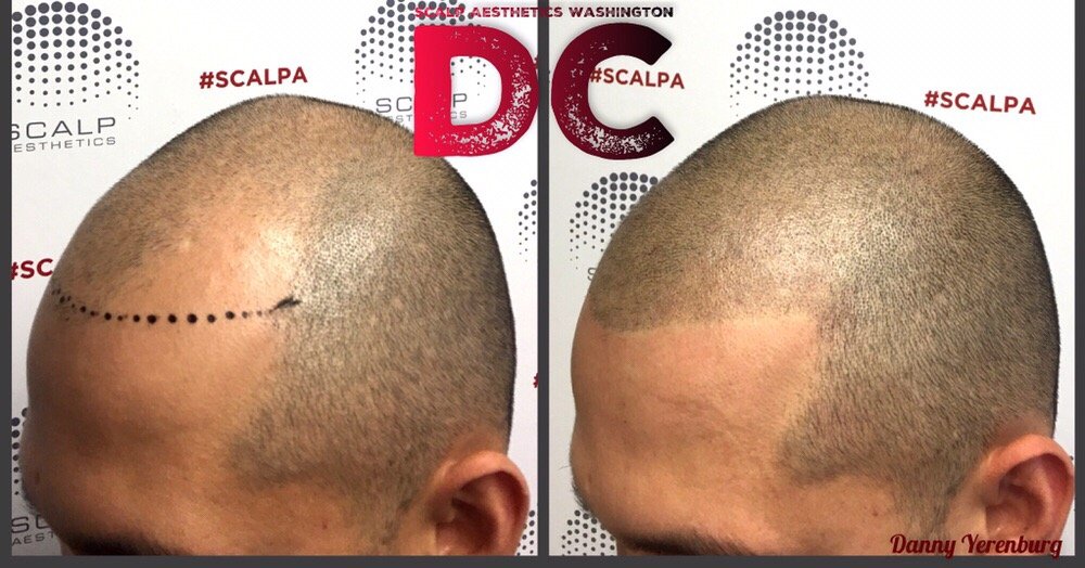 Scalp Allure