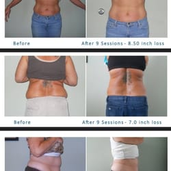 How to lose weight after pregnancy while breastfeeding photo 4