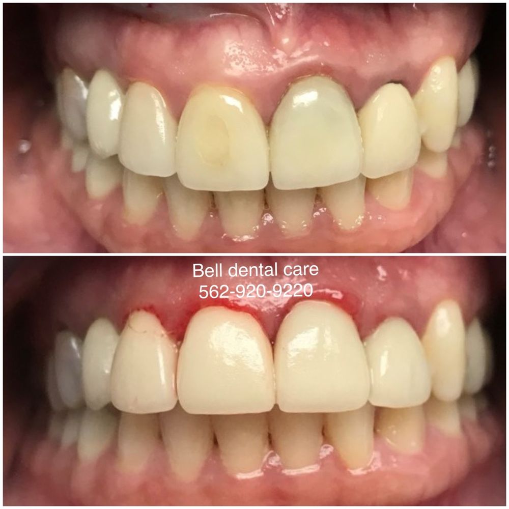 image of business Bell Dental Care