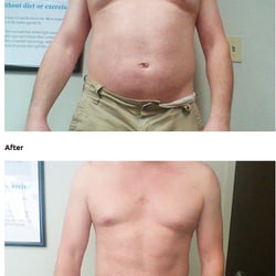 Pastila de slabit garcinia cambogia veda photo 3