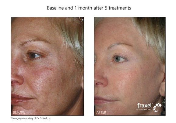 Fountain of Youth Medical Spa