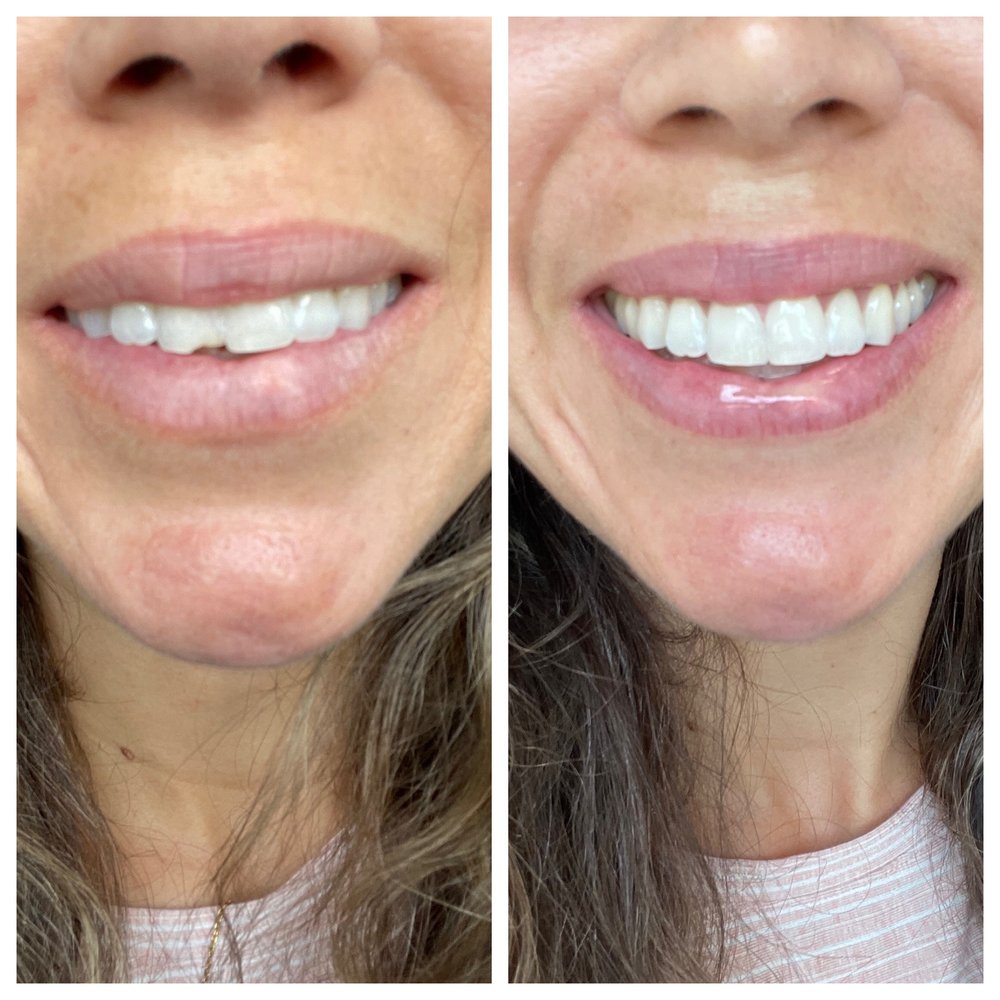 image of business Confident Smiles & Implants