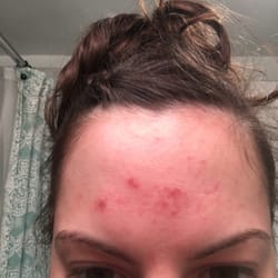 Skin Spa Murray Hill Reviews Skin Spa Murray Hill Reviews