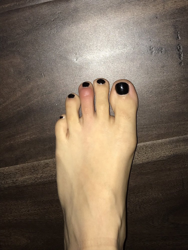 O