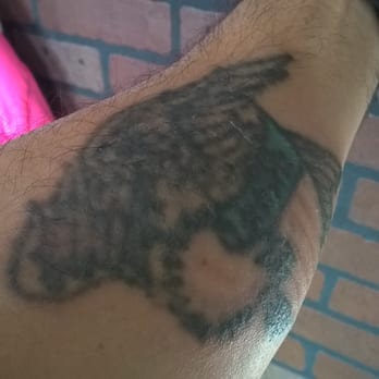 vamoose tattoo removal 17 reviews tattoo removal 4347 n vamoose tattoo removal 17 reviews tattoo removal 4347 n