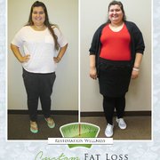 Will walking with ankle weights help me lose weight picture 3