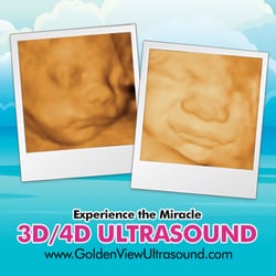 3d ultrasound bronx ny photo of goldenview ultrasound 3d4dhd nyc new york ny 60 photos reviews 3d ultrasound bronx ny photo of goldenview ultrasound 3d4dhd nyc new york ny 60 photos reviews