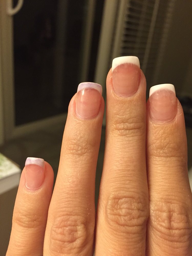 The Gel Started To Turn Black I Had To File It Down On The First 2 The Gel Started To Turn Black I Had To File It Down On The First 2