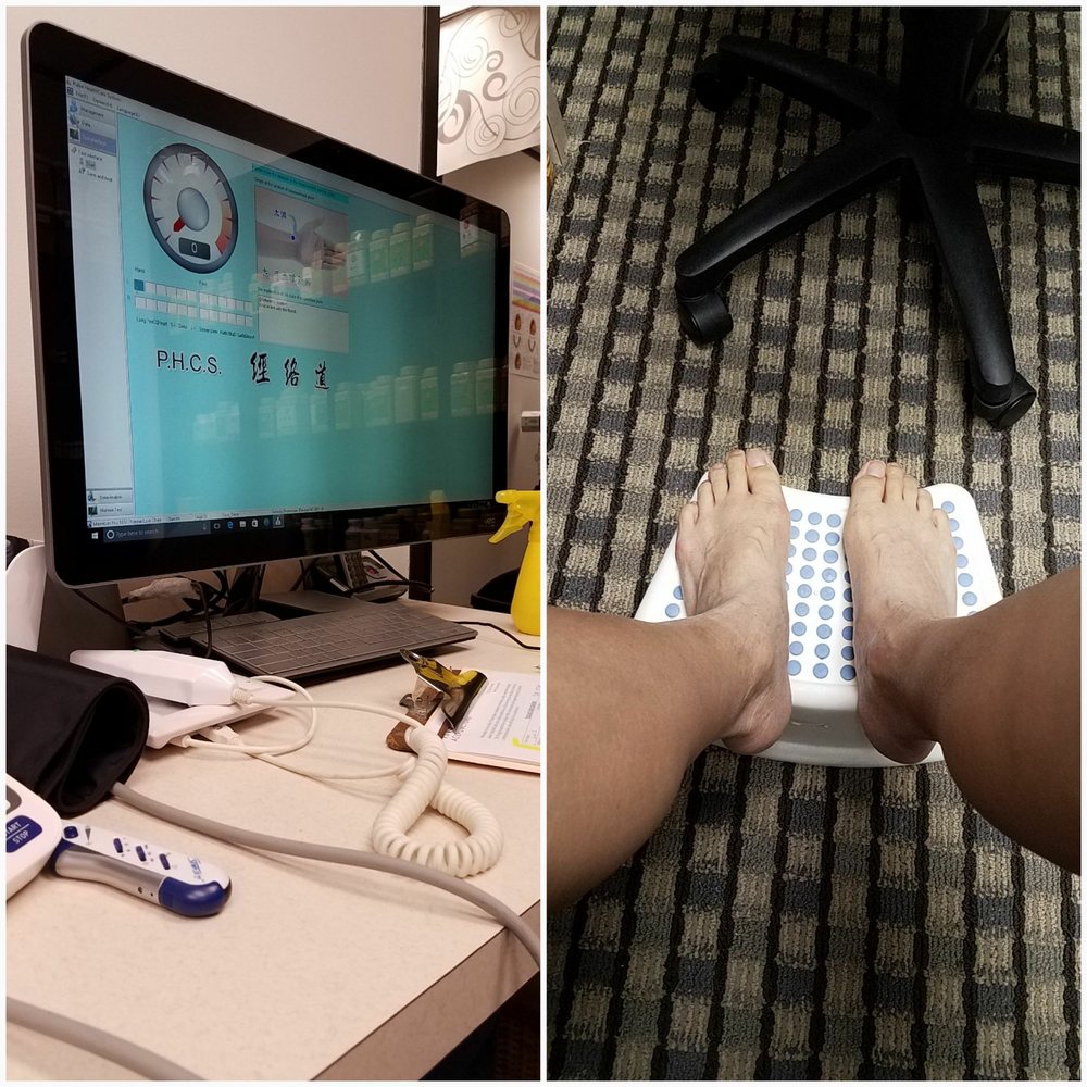 Cupping Yin Yang Acupuncture