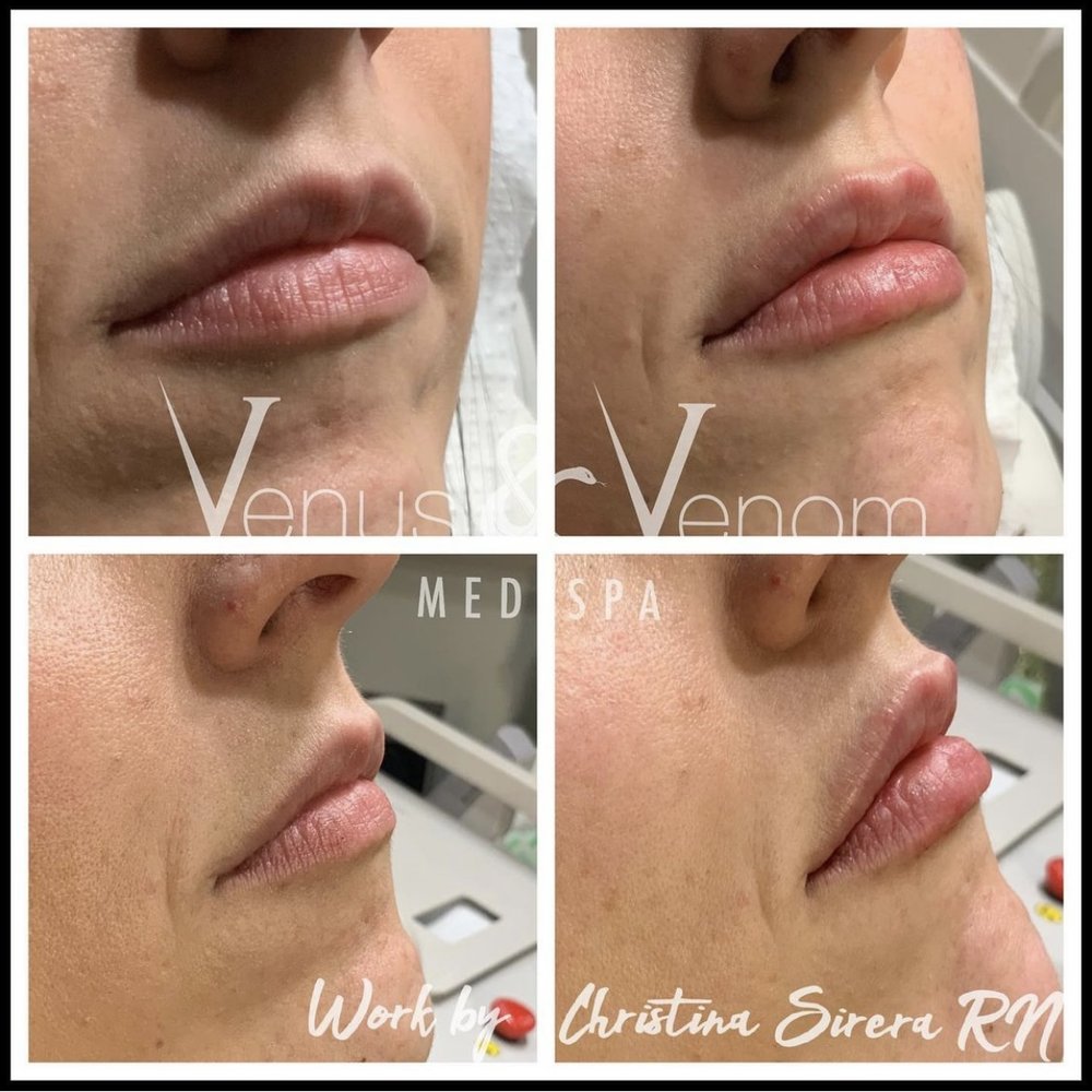 Venus & Venom Blauvelt