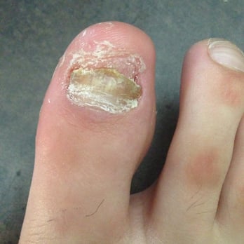 neat feet podiatry laser center closed 17 reviews podiatrists