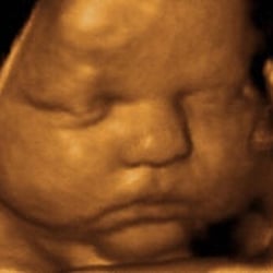 prenatal impressions 3d ultrasound center of orlando 10 ultrasounds orlando