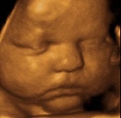 ultrasounds orlando