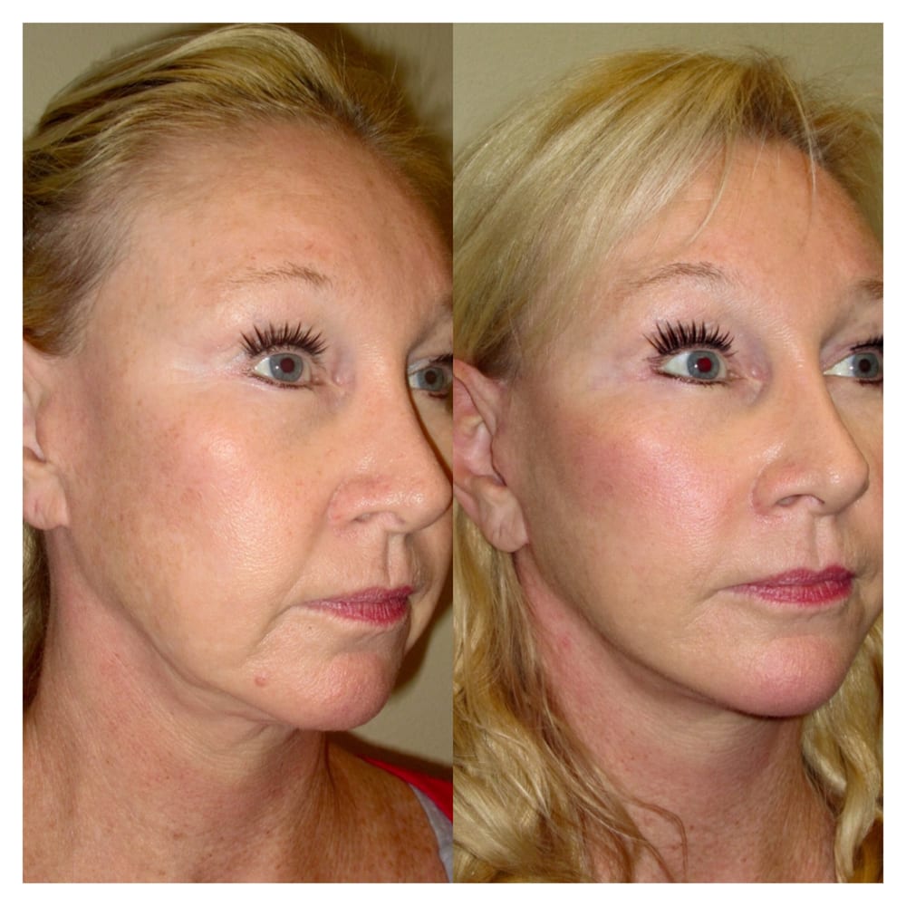 Center for facial cosmetics not the Well center for facial cosmetics apologise, but