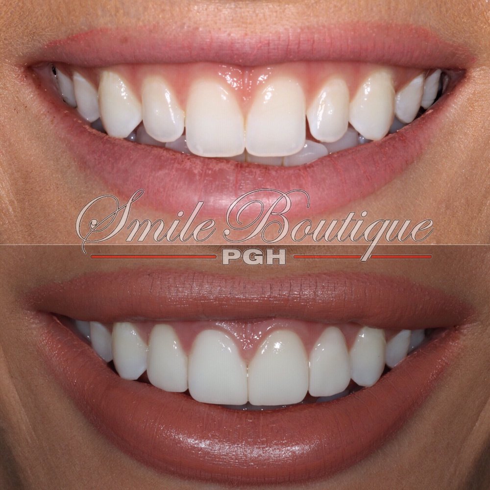 image of business PGH Smile Boutique