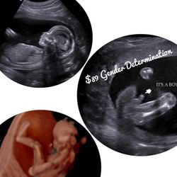 ultrasounds orlando