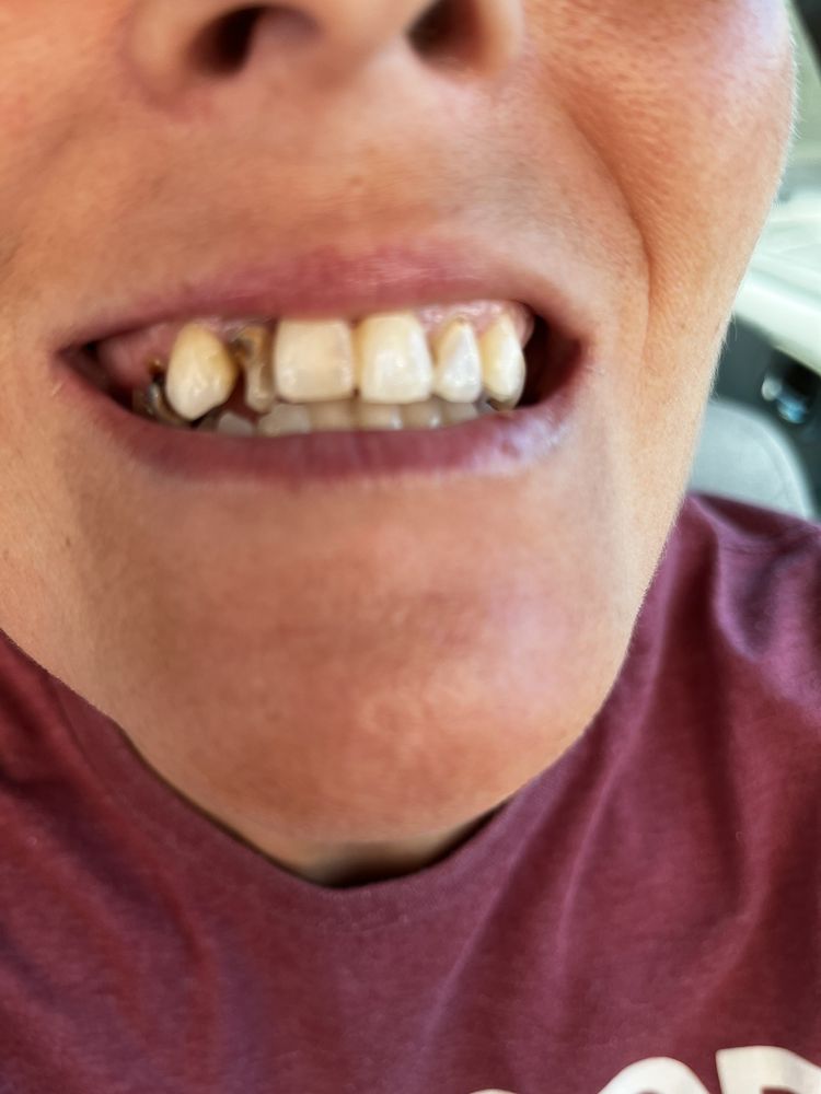 image of business Great Expressions Dental Centers - Stuart