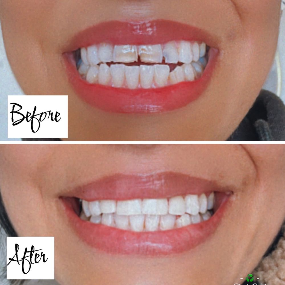 image of business Avalon Dental - Dr. Elizabeth Dinh