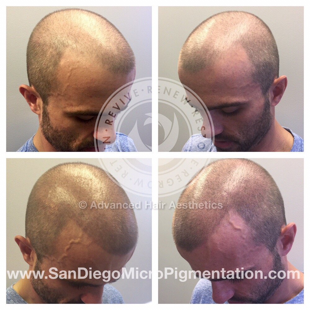 Advanced Hair Aesthetics 27 Photos Hair Loss Centers 5830 Oberlin