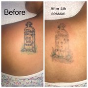 laseraway 46 photos u0026 59 reviews tattoo removal 410 castro laseraway 46 photos u0026 59 reviews tattoo removal 410 castro