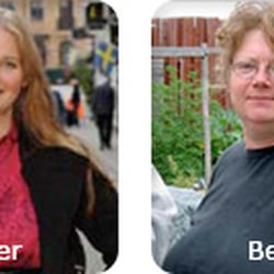 Bags under eyes after weight loss photo 6