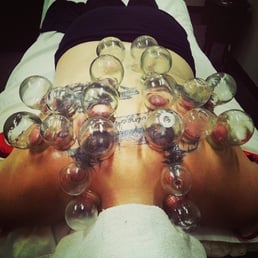 Best health option- acupuncture & wellness rivercrest drive germantown wi