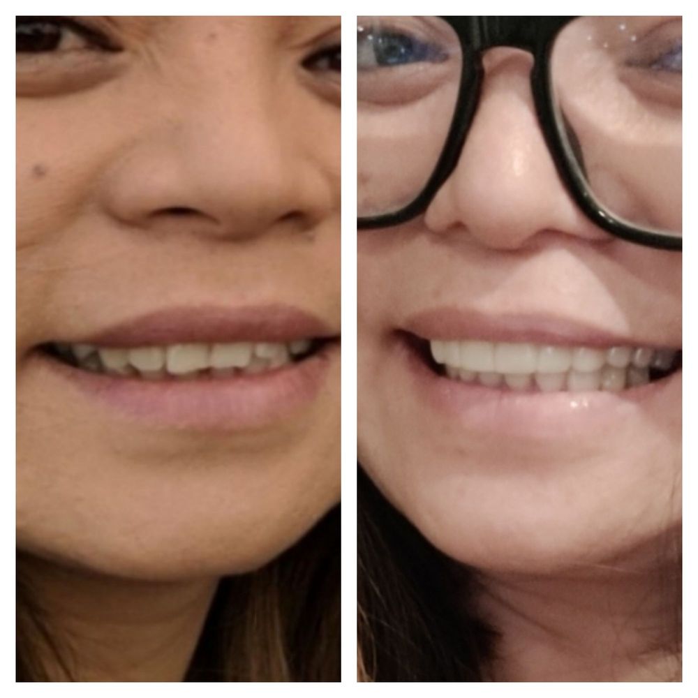 image of business Smile Artistry Chino Valley
